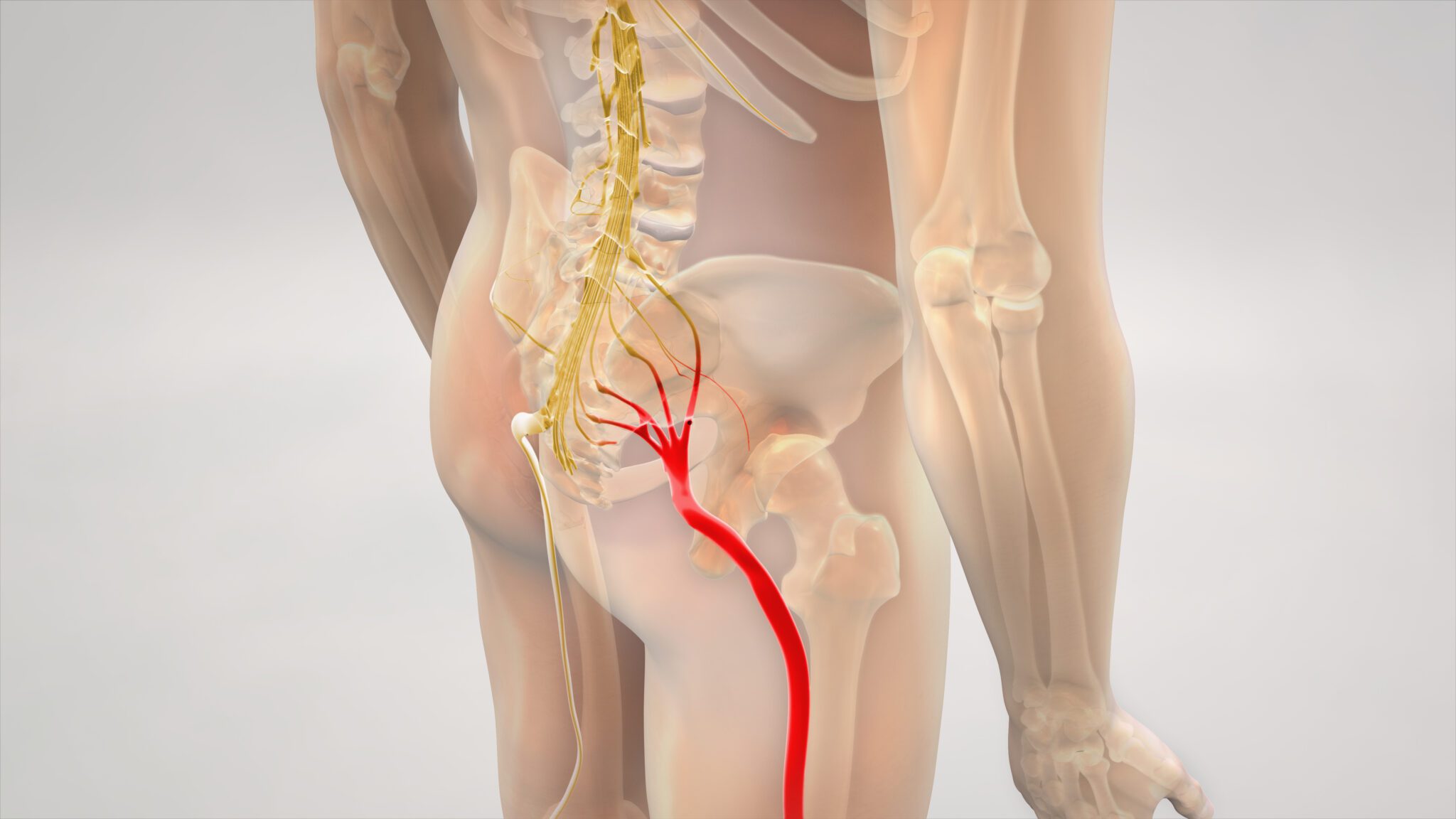 Sciatica Pain Treatment in Jaipur